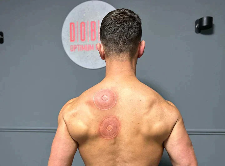 SmartCup Cupping Massager — Relieve Muscle Pain & Tension at Home