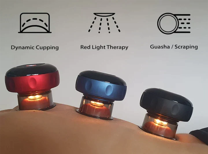SmartCup Cupping Massager — Relieve Muscle Pain & Tension at Home